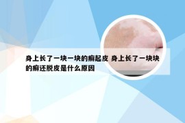 身上长了一块一块的癣起皮 身上长了一块块的癣还脱皮是什么原因