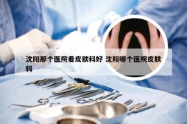 沈阳那个医院看皮肤科好 沈阳哪个医院皮肤科