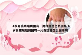 4岁男孩眼睛周围有一片白斑是怎么回事 4岁男孩眼睛周围有一片白斑是怎么回事啊