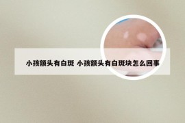 小孩额头有白斑 小孩额头有白斑块怎么回事