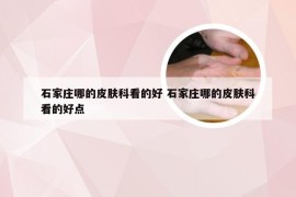 石家庄哪的皮肤科看的好 石家庄哪的皮肤科看的好点