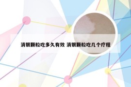 消银颗粒吃多久有效 消银颗粒吃几个疗程