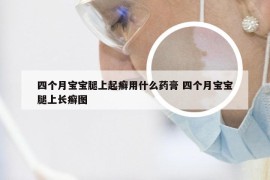 四个月宝宝腿上起癣用什么药膏 四个月宝宝腿上长癣图