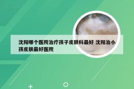 沈阳哪个医院治疗孩子皮肤科最好 沈阳治小孩皮肤最好医院