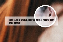 做什么检查能查出银屑病 做什么检查能查出银屑病患者