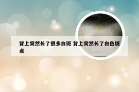 背上突然长了很多白斑 背上突然长了白色斑点