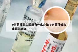 9岁男孩头上起癣有什么办法 9岁男孩长头皮屑怎么办