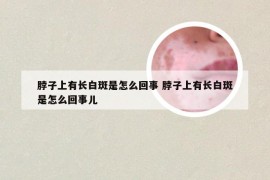 脖子上有长白斑是怎么回事 脖子上有长白斑是怎么回事儿