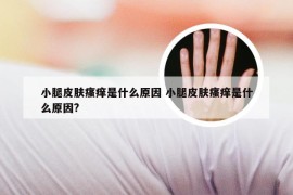 小腿皮肤瘙痒是什么原因 小腿皮肤瘙痒是什么原因?