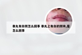 睾丸有白斑怎么回事 睾丸上有白的斑块,是怎么回事