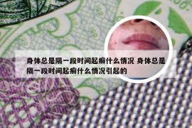 身体总是隔一段时间起癣什么情况 身体总是隔一段时间起癣什么情况引起的