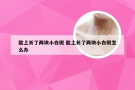 脸上长了两块小白斑 脸上长了两块小白斑怎么办