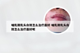 哺乳期乳头白斑怎么治疗最好 哺乳期乳头白斑怎么治疗最好呢