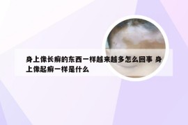 身上像长癣的东西一样越来越多怎么回事 身上像起癣一样是什么