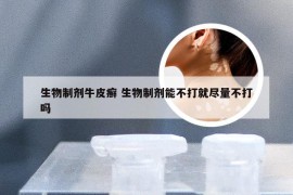 生物制剂牛皮癣 生物制剂能不打就尽量不打吗