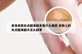 身体皮肤白点越来越多是什么病症 皮肤上的白点越来越大怎么回事