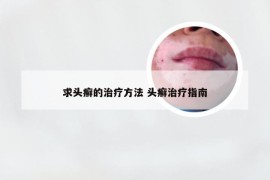 求头癣的治疗方法 头癣治疗指南