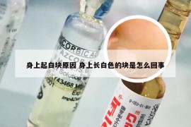 身上起白块原因 身上长白色的块是怎么回事