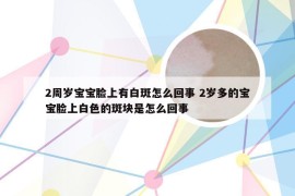 2周岁宝宝脸上有白斑怎么回事 2岁多的宝宝脸上白色的斑块是怎么回事