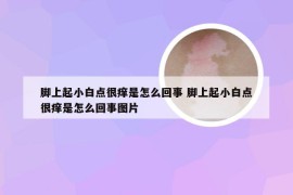 脚上起小白点很痒是怎么回事 脚上起小白点很痒是怎么回事图片