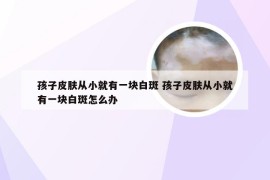 孩子皮肤从小就有一块白斑 孩子皮肤从小就有一块白斑怎么办