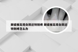 脚底板出现白斑还特别疼 脚底板出现白斑还特别疼怎么办