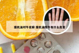 废机油对牛皮癣 废机油擦牛有什么危害