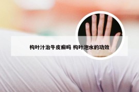 构叶汁治牛皮癣吗 构叶泡水的功效