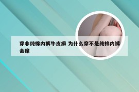 穿非纯棉内裤牛皮癣 为什么穿不是纯棉内裤会痒