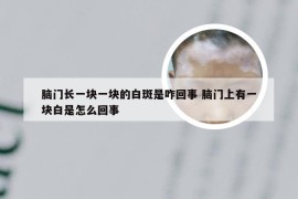 脑门长一块一块的白斑是咋回事 脑门上有一块白是怎么回事