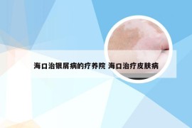 海口治银屑病的疗养院 海口治疗皮肤病