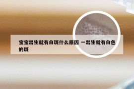 宝宝出生就有白斑什么原因 一出生就有白色的斑