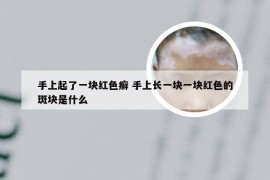 手上起了一块红色癣 手上长一块一块红色的斑块是什么