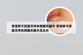 宝宝脖子后面又块白斑越长越大 宝宝脖子后面又块白斑越长越大怎么办