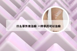 什么草外用治癣 一种草药可以治癣