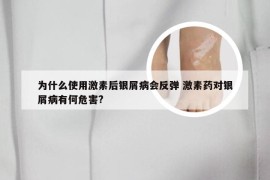 为什么使用激素后银屑病会反弹 激素药对银屑病有何危害?