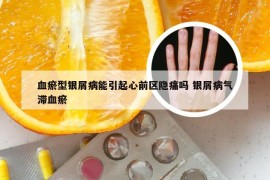 血瘀型银屑病能引起心前区隐痛吗 银屑病气滞血瘀