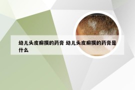 幼儿头皮癣摸的药膏 幼儿头皮癣摸的药膏是什么