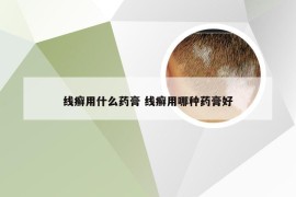 线癣用什么药膏 线癣用哪种药膏好