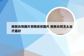 膀胱白斑图片初期症状图片 膀胱白斑怎么治疗最好