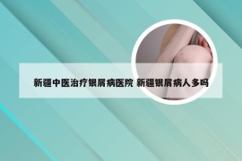 新疆中医治疗银屑病医院 新疆银屑病人多吗