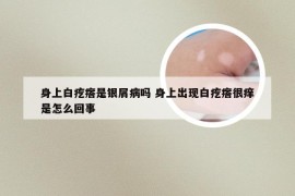 身上白疙瘩是银屑病吗 身上出现白疙瘩很痒是怎么回事