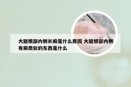 大腿根部内侧长癣是什么原因 大腿根部内侧有癣类似的东西是什么