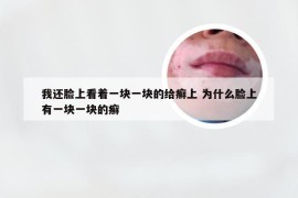 我还脸上看着一块一块的给癣上 为什么脸上有一块一块的癣