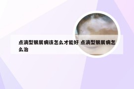 点滴型银屑病该怎么才能好 点滴型银屑病怎么治