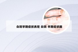 白斑早期症状表现 白斑 早期症状图