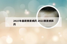 2023年最新银屑病药 2021银屑病新药