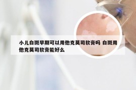 小儿白斑早期可以用他克莫司软膏吗 白斑用他克莫司软膏能好么