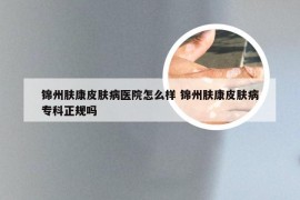 锦州肤康皮肤病医院怎么样 锦州肤康皮肤病专科正规吗