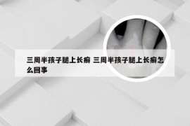 三周半孩子腿上长癣 三周半孩子腿上长癣怎么回事